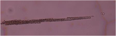 Bundle with filaments of the cyanobacterium Aphanizomenon sp.