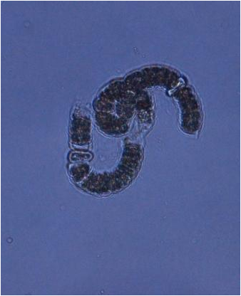 The cyanobacterium Nodularia spumigena. Two square-formed heterocysts with thick cell-walls are visible close to the ends of the filament.