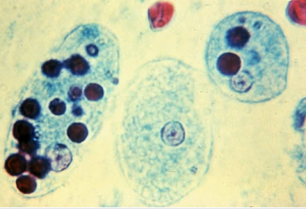 Photo of Entamoeba histolytica