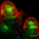 ExpansinA1_YFP_inflorescence_meristerm1.tif