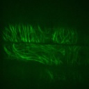 Tubulin-alpha-YFP.15.jpg