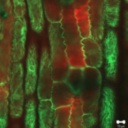 Tubulin-alpha-YFP.6.jpg